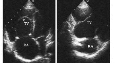 pagenumber_ebook=376,pagenumber_book=376