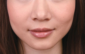 pagenumber_ebook=101,pagenumber_book=93