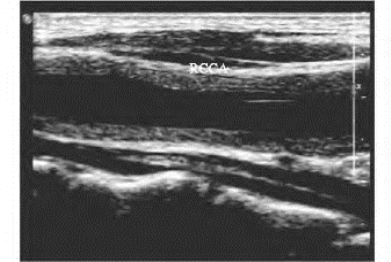 pagenumber_ebook=479,pagenumber_book=479