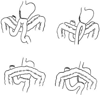 pagenumber_ebook=323,pagenumber_book=308