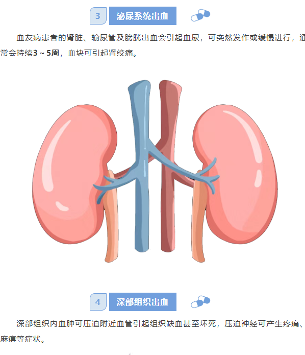 image.png?v=1777161396972