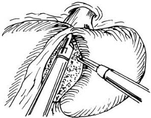 pagenumber_ebook=482,pagenumber_book=467