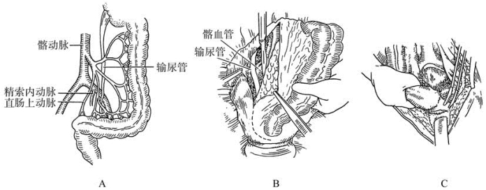 pagenumber_ebook=240,pagenumber_book=225