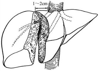 pagenumber_ebook=472,pagenumber_book=457