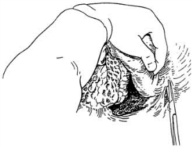 pagenumber_ebook=99,pagenumber_book=84