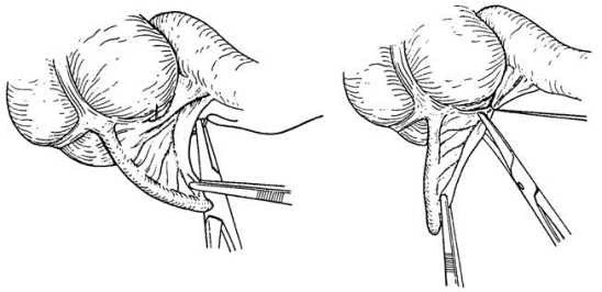 pagenumber_ebook=545,pagenumber_book=530
