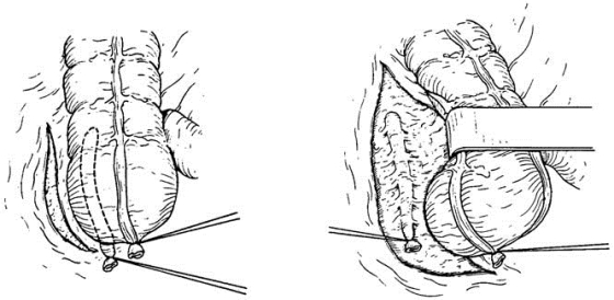 pagenumber_ebook=546,pagenumber_book=531
