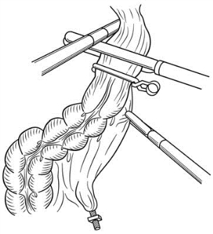 pagenumber_ebook=426,pagenumber_book=411