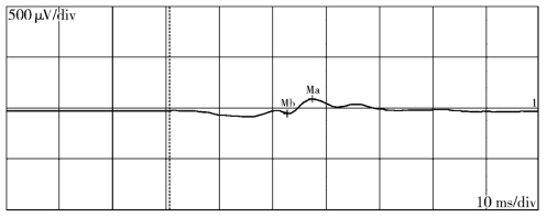 pagenumber_ebook=152,pagenumber_book=127