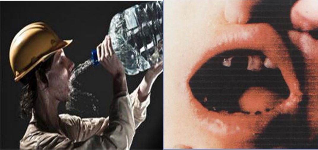 12.1-6 口渴 龋齿.jpg