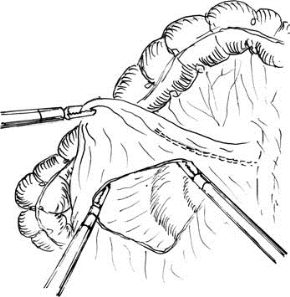 pagenumber_ebook=396,pagenumber_book=381