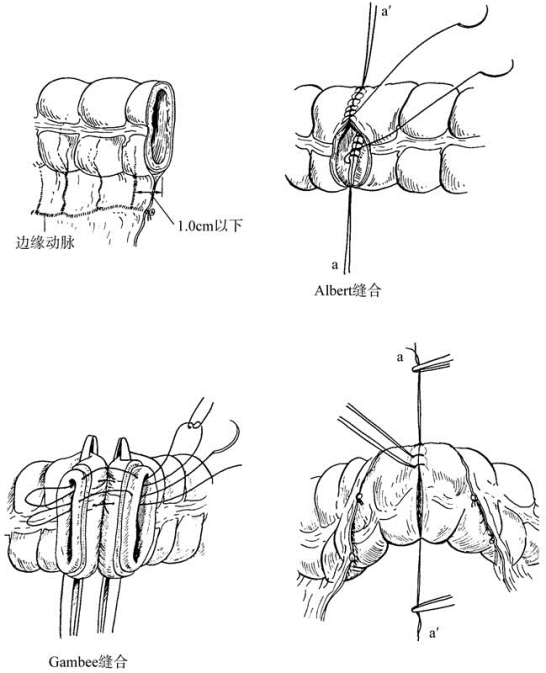 pagenumber_ebook=393,pagenumber_book=378