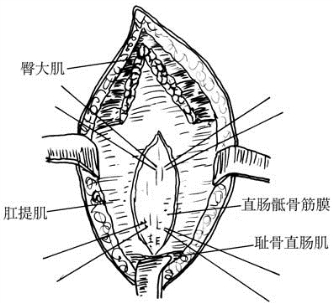pagenumber_ebook=526,pagenumber_book=511