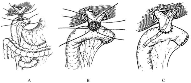 pagenumber_ebook=455,pagenumber_book=440