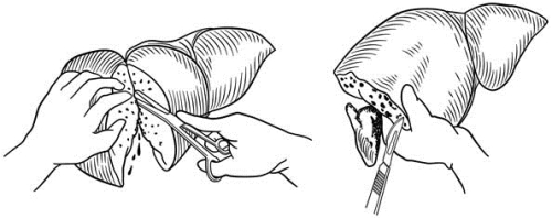 pagenumber_ebook=577,pagenumber_book=562