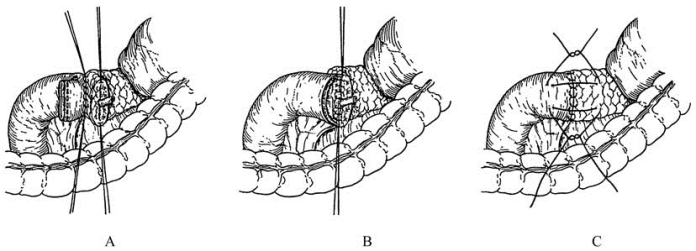 pagenumber_ebook=496,pagenumber_book=481