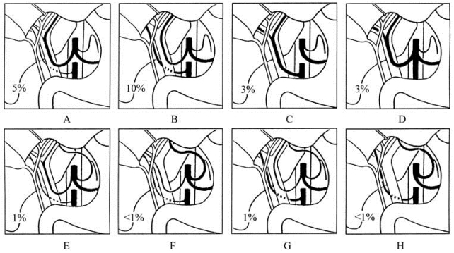 pagenumber_ebook=111,pagenumber_book=96