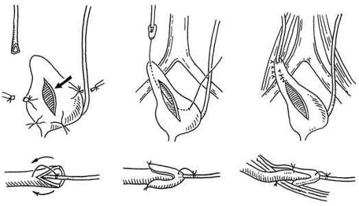 pagenumber_ebook=243,pagenumber_book=228