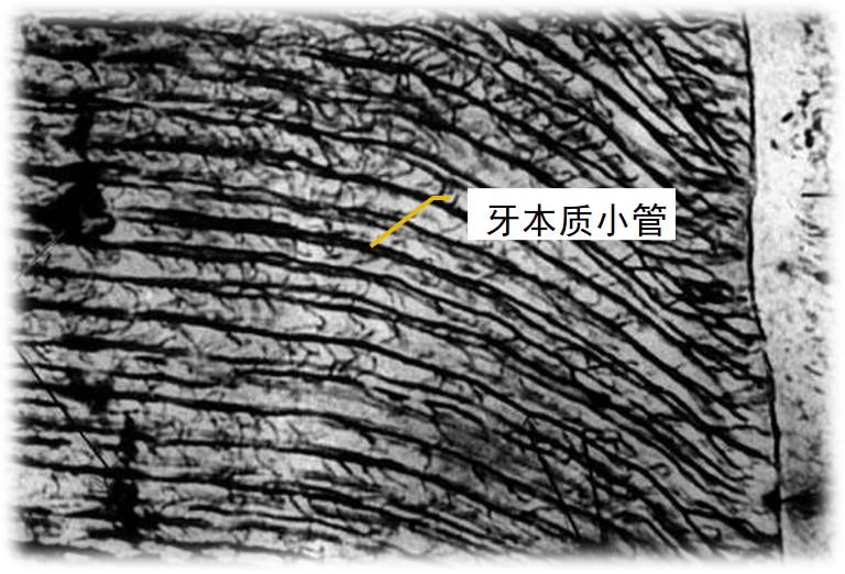 3.2-1 牙本质小管.jpg