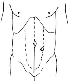 pagenumber_ebook=171,pagenumber_book=156