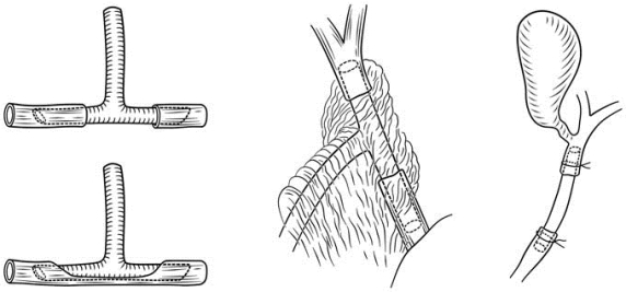 pagenumber_ebook=231,pagenumber_book=216