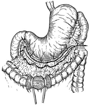 pagenumber_ebook=383,pagenumber_book=368