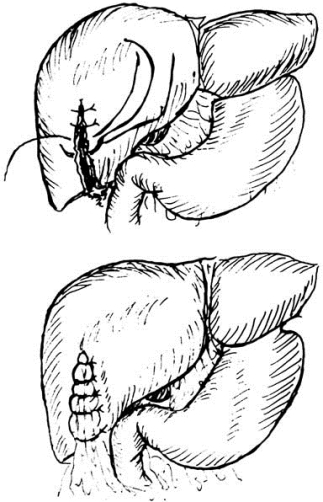 pagenumber_ebook=576,pagenumber_book=561