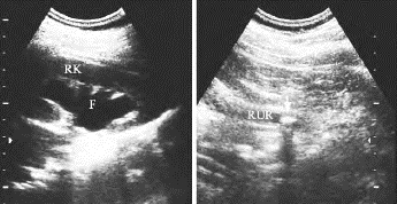 pagenumber_ebook=626,pagenumber_book=626