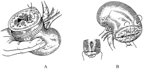 pagenumber_ebook=124,pagenumber_book=109