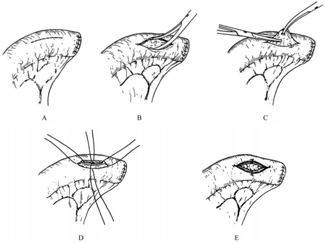pagenumber_ebook=454,pagenumber_book=439