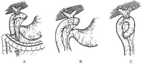 pagenumber_ebook=455,pagenumber_book=440