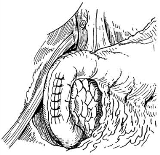 pagenumber_ebook=446,pagenumber_book=431