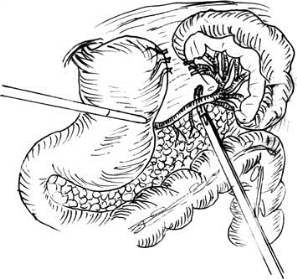 pagenumber_ebook=515,pagenumber_book=500