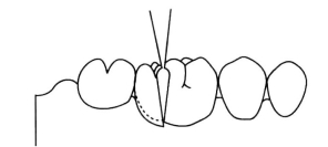 pagenumber_ebook=242,pagenumber_book=233