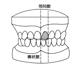 pagenumber_ebook=238,pagenumber_book=229