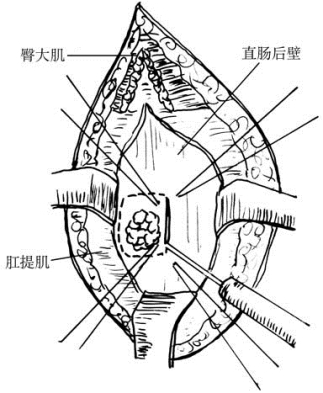 pagenumber_ebook=526,pagenumber_book=511