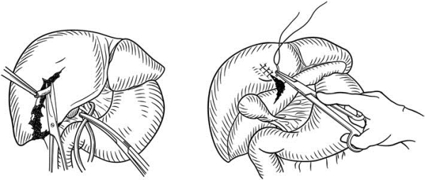 pagenumber_ebook=574,pagenumber_book=559