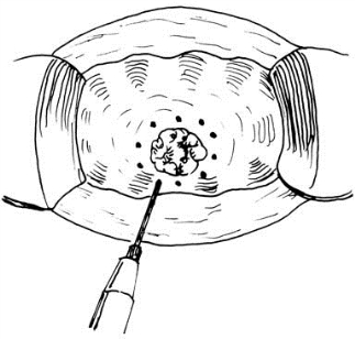 pagenumber_ebook=525,pagenumber_book=510