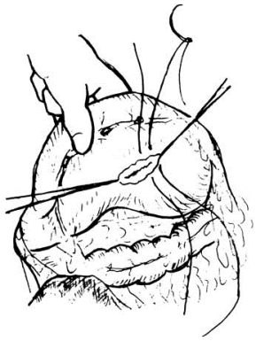 pagenumber_ebook=563,pagenumber_book=548