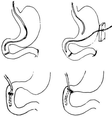 pagenumber_ebook=565,pagenumber_book=550