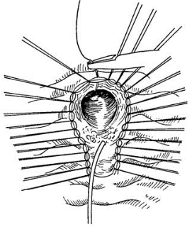 pagenumber_ebook=445,pagenumber_book=430