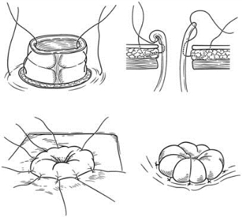 pagenumber_ebook=412,pagenumber_book=397