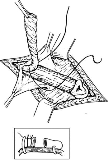 pagenumber_ebook=589,pagenumber_book=574