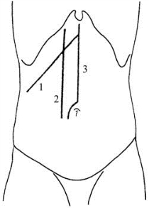 pagenumber_ebook=76,pagenumber_book=61