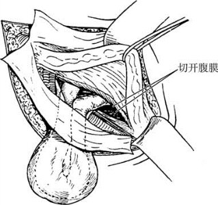 pagenumber_ebook=597,pagenumber_book=582