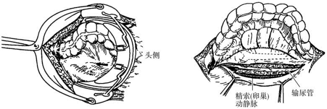 pagenumber_ebook=408,pagenumber_book=393