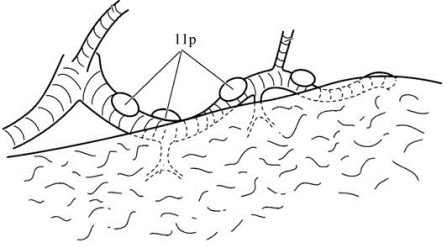pagenumber_ebook=332,pagenumber_book=317