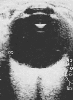 pagenumber_ebook=110,pagenumber_book=110