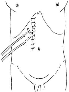 pagenumber_ebook=440,pagenumber_book=425