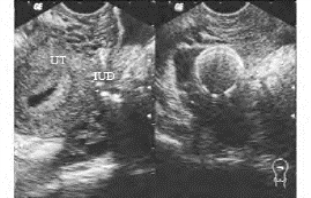 pagenumber_ebook=702,pagenumber_book=702